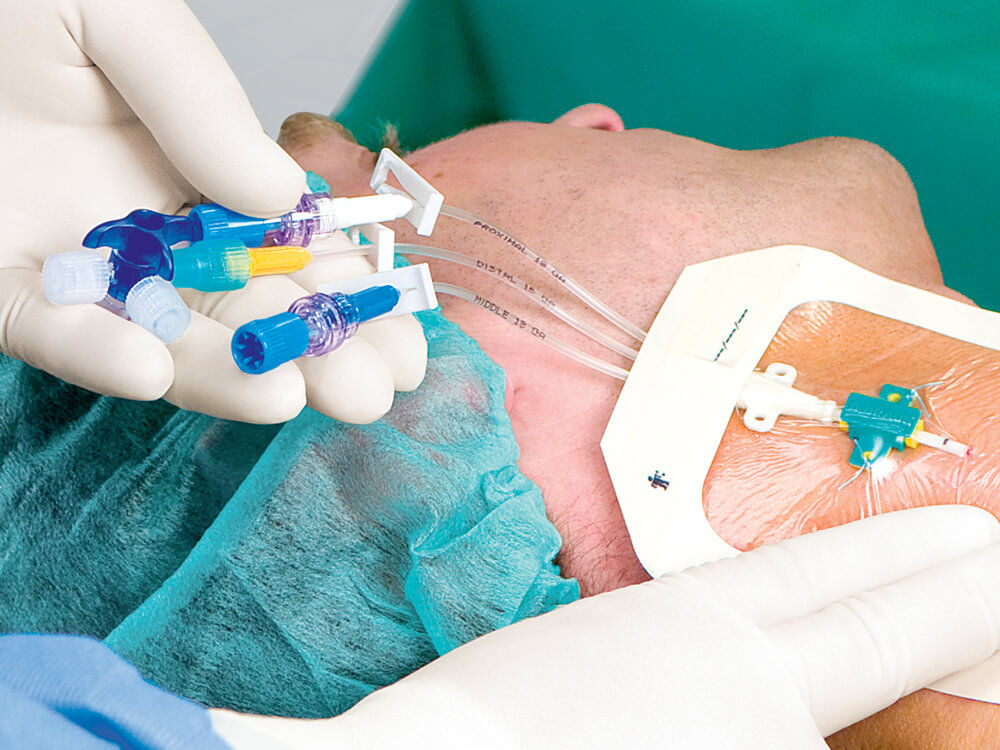 Abdeckung des platzierten Certofix Trio Katheters mit transparentem Verband – medizinische Fachkraft mit Handschuhen, Patient mit grüner Kappe