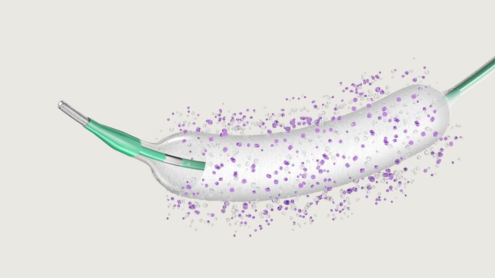 SeQuent® SCB – Sirolimus-beschichteter Ballon