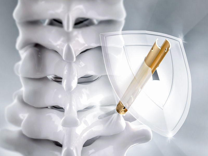 Ennovate® Cervical MIS – minimaler Eingriff. Erhöhter Schutz.