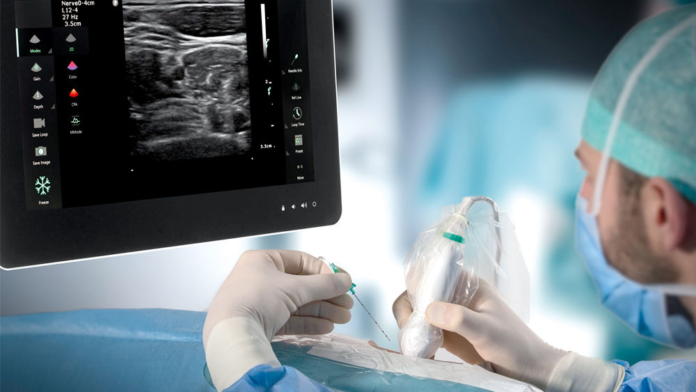 Der Anästhesist führt ein ultraschallgeführtes Regionalanästhesieverfahren bei einem Patienten mit der B. Braun Nervenblockadenadel und der EZCOVER Sondenabdeckung zur Infektionsprävention durch.