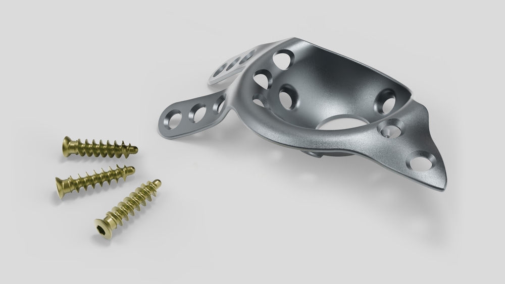 Rekonstruktionsschalenprodukt