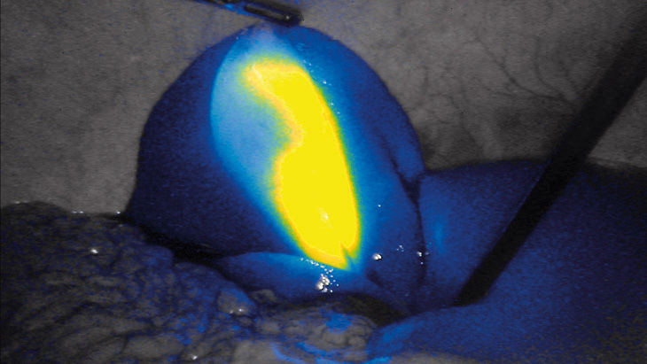 FI-Intensität – 3D-Fluoreszenzbildgebungstechnologie