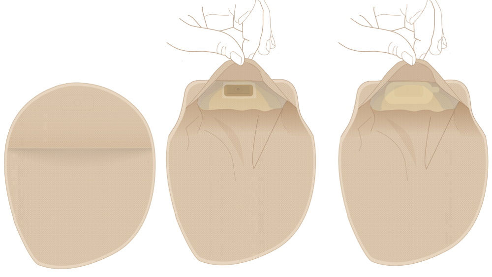 Stomabeutel mit Sichtfenster  