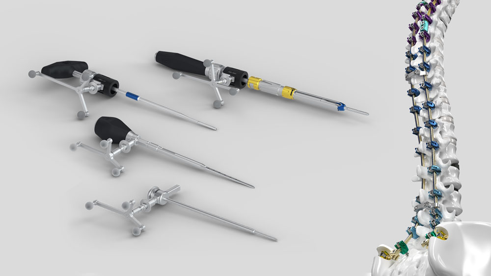 Ennovate® Wirbelsäulennavigation