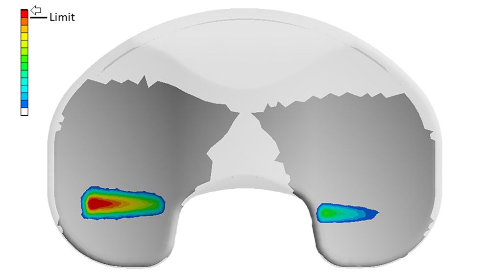 Der Druck des Implantats wird auf dem Display angezeigt