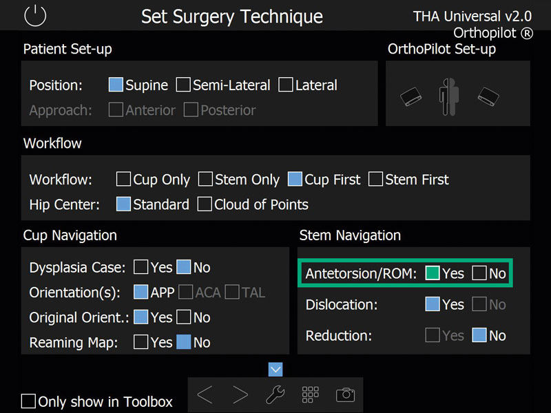 Screenshot THA Pro Navigationssoftware Hüftarthroplastik