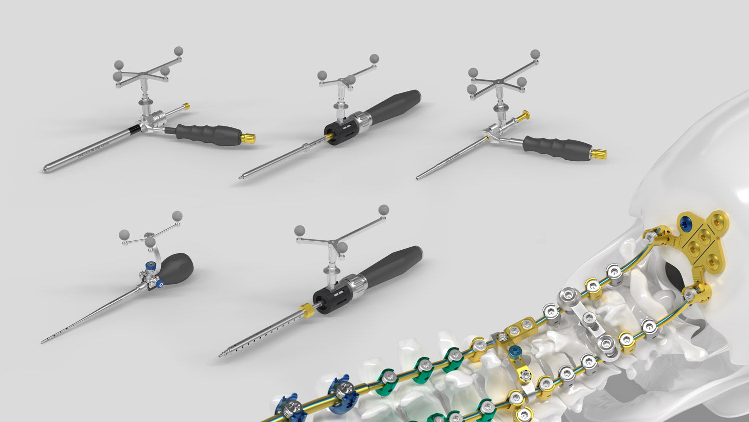 Ennovate® Wirbelsäulennavigation