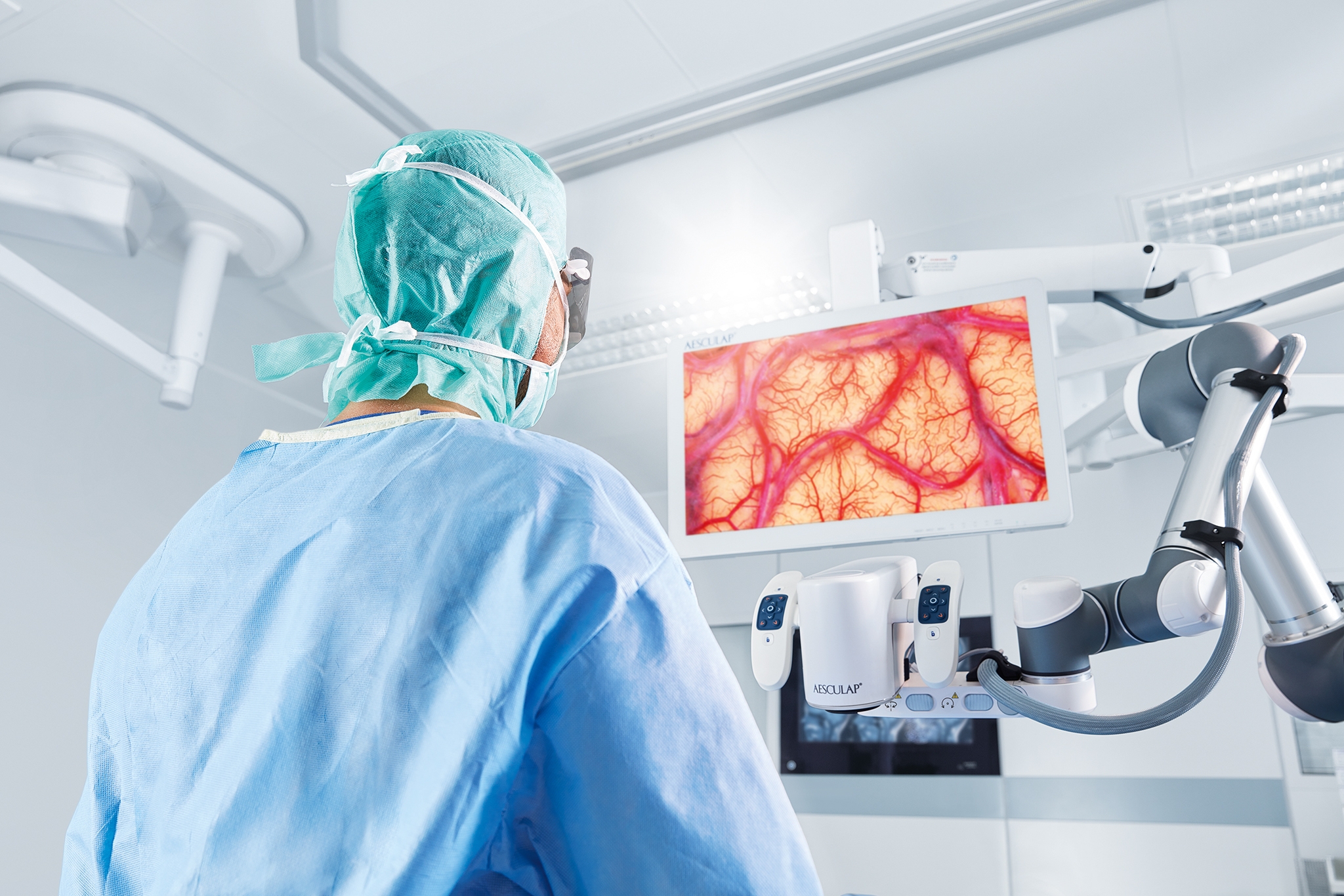 Aesculap Aeos® is a robotic-assisted digital surgical microscope platform. It unites ergonomic aspects with a remarkable imaging quality – a new level of vision and comfort for microsurgeons.