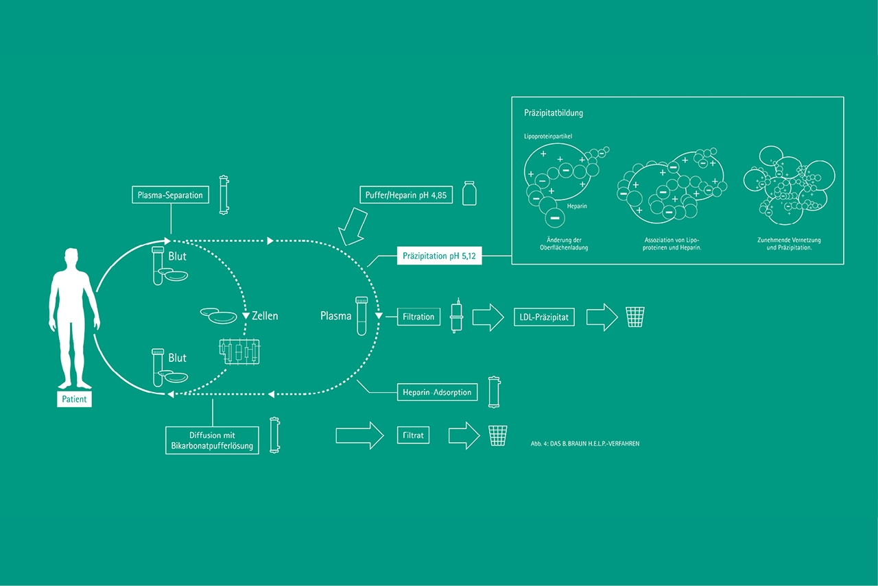 Grafik: Prinzip der Präzipitation
