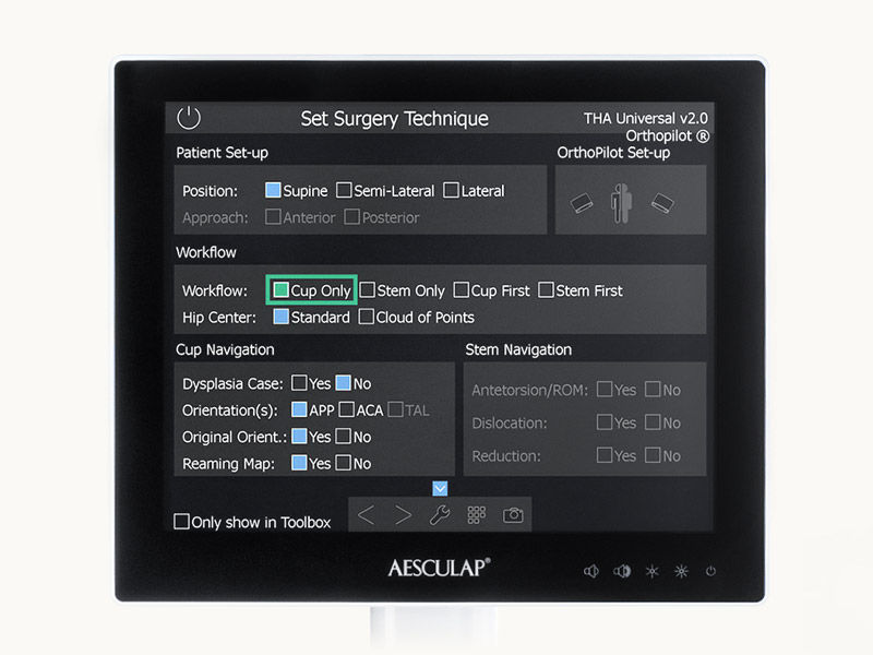Screenshot der Pfannen-Navigationssoftware – Hüftendoprothetik