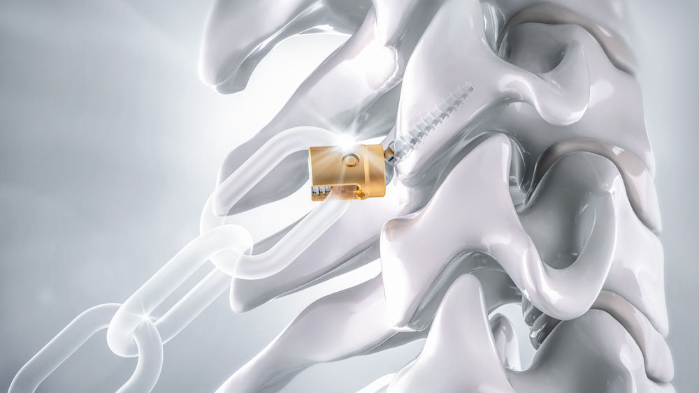 Ennovate® Cervical EnnoCore