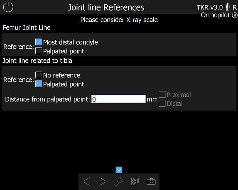 Screenshot der OrthoPilot® TKR Software – Gelenklinienreferenz