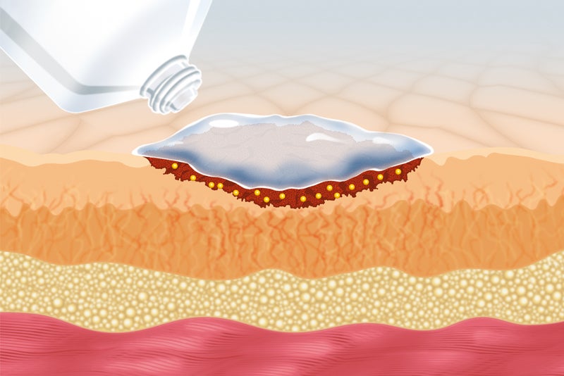 Prontosan® Wound Gel und Prontosan® Wound Gel X