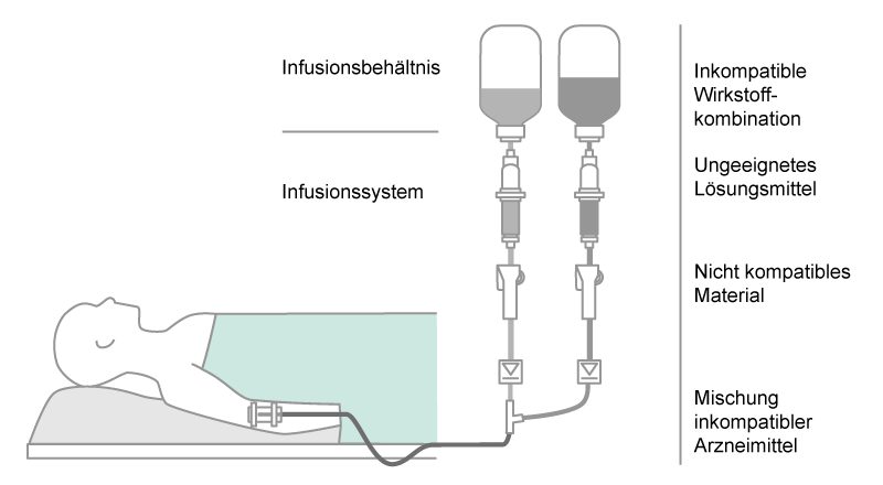 Parallel infusion in standard IV therapy.