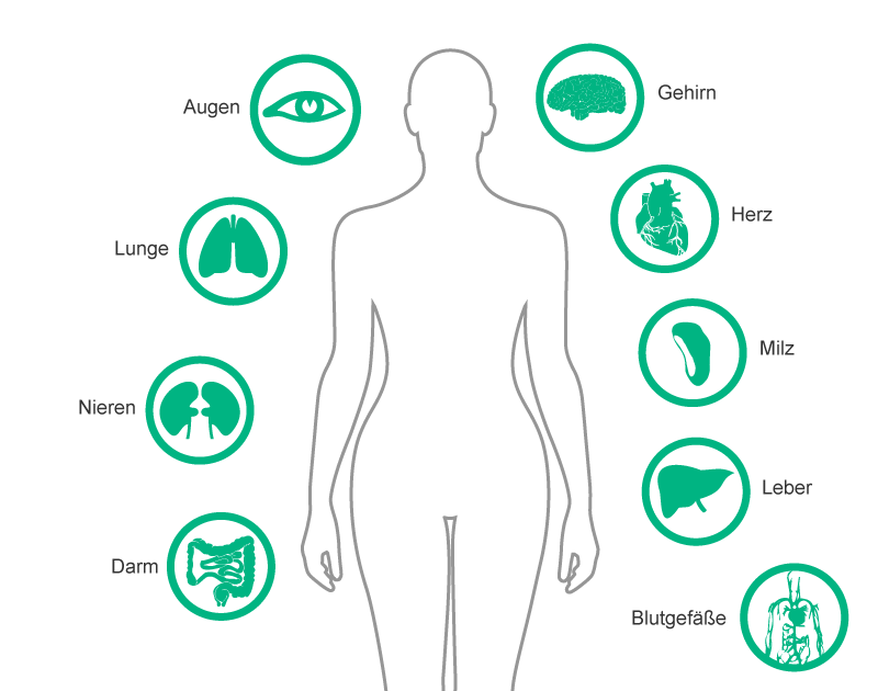 Parts and organs of the human body mainly affected by particulate contamination of IV fluids: Eye, Lung, Kidney, Intestine, Brain, Heart, Spleen, Liver, Blood Vessels.