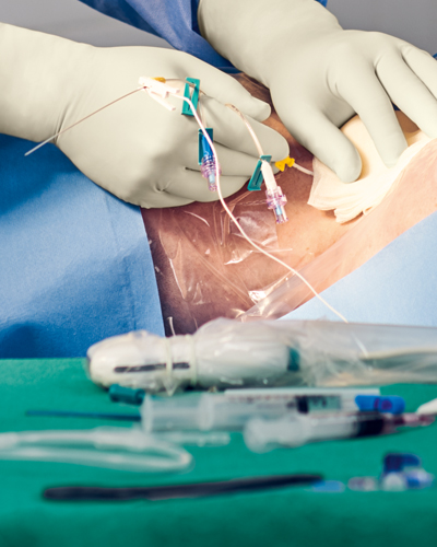 Hände eines medizinischen Mitarbeiters verbinden zentralvenöse Zugangsgeräte mit dem Patienten