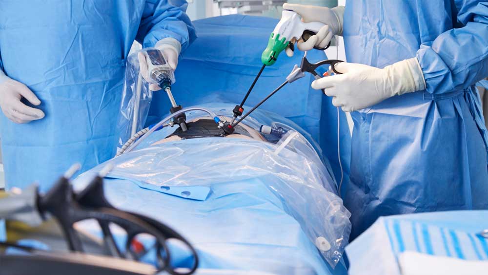 Ein Detail einer minimalinvasiven Operationssituation mit AESCULAP Caiman