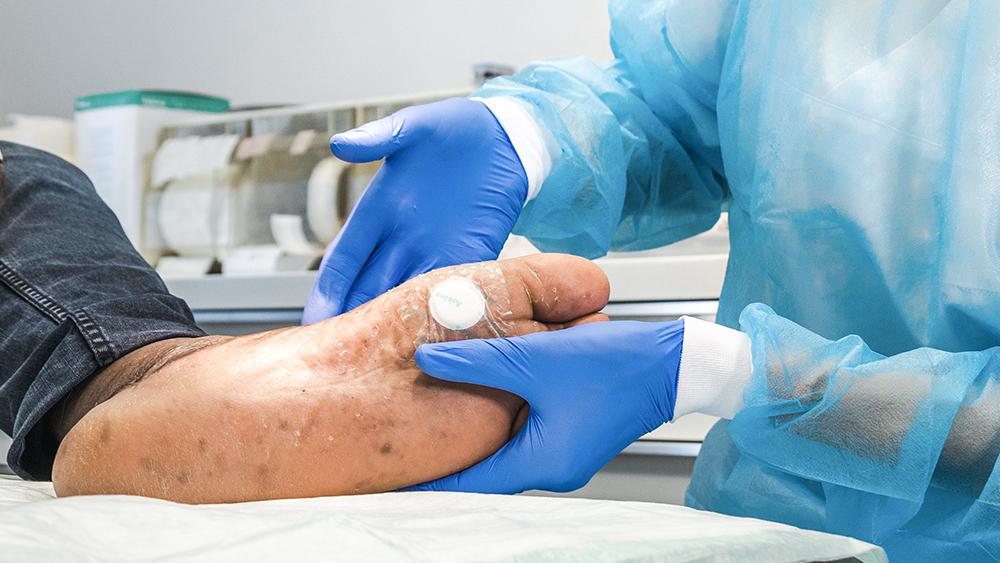 Zwei Hände mit Handschuhen untersuchen einen Fuß mit Pflaster.